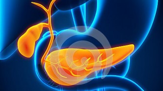 Résection d’un cancer de la vésicule biliaire avec métastase hépatique après chimiothérapie néoadjuvante à base de Gemcitabine