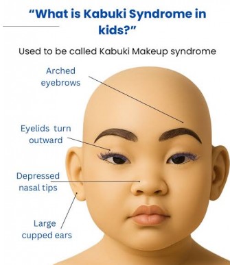 Le syndrome de Kabuki (SK)