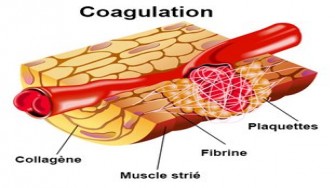 Cancers solides et thrombopénies de causes aigües