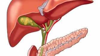 Cancer des voies biliaires : résultats décevants d’une trithérapie.