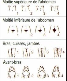  Score de l'hirsutisme (selon Ferriman et Gallwey)