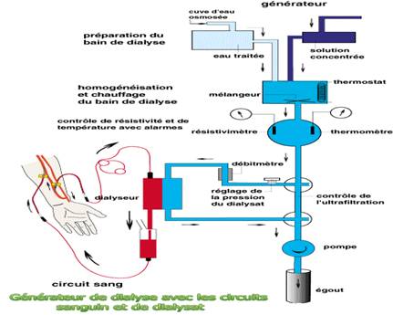 Générateur d’hémodialyse