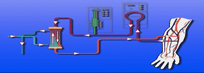 Représentation schématique d’une séance d’hémodialyse