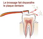 le brossage des dents