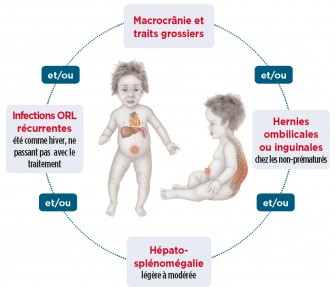 Mucopolysaccharidose