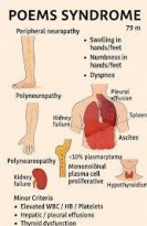 Syndrome de poems