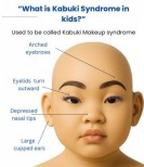 Le syndrome de Kabuki (SK)