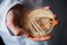 Candida auris : le champignon multir&eacute;sistant qui inqui&egrave;te les &eacute;tablissements de sant&eacute;